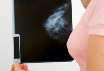 Маммография: для тех, кому за 30…