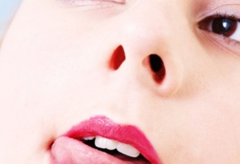 Обветренные губы: лечение