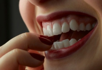 Как добиться белизны зубов 