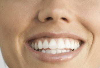 Проверенные методы отбеливания зубов