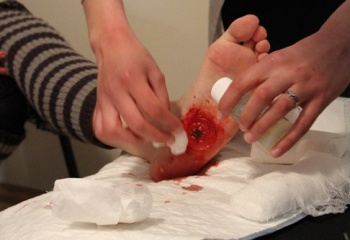 Как промыть рану 