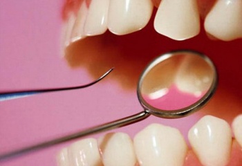Как самостоятельно восстановить эмаль зубов