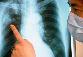 Как защититься от туберкулеза