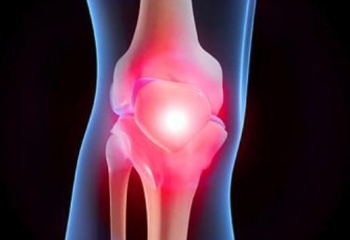 Как укрепить коленный сустав