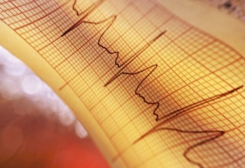 Как определить инфаркт