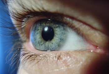 Как лечить заболевание глаз 